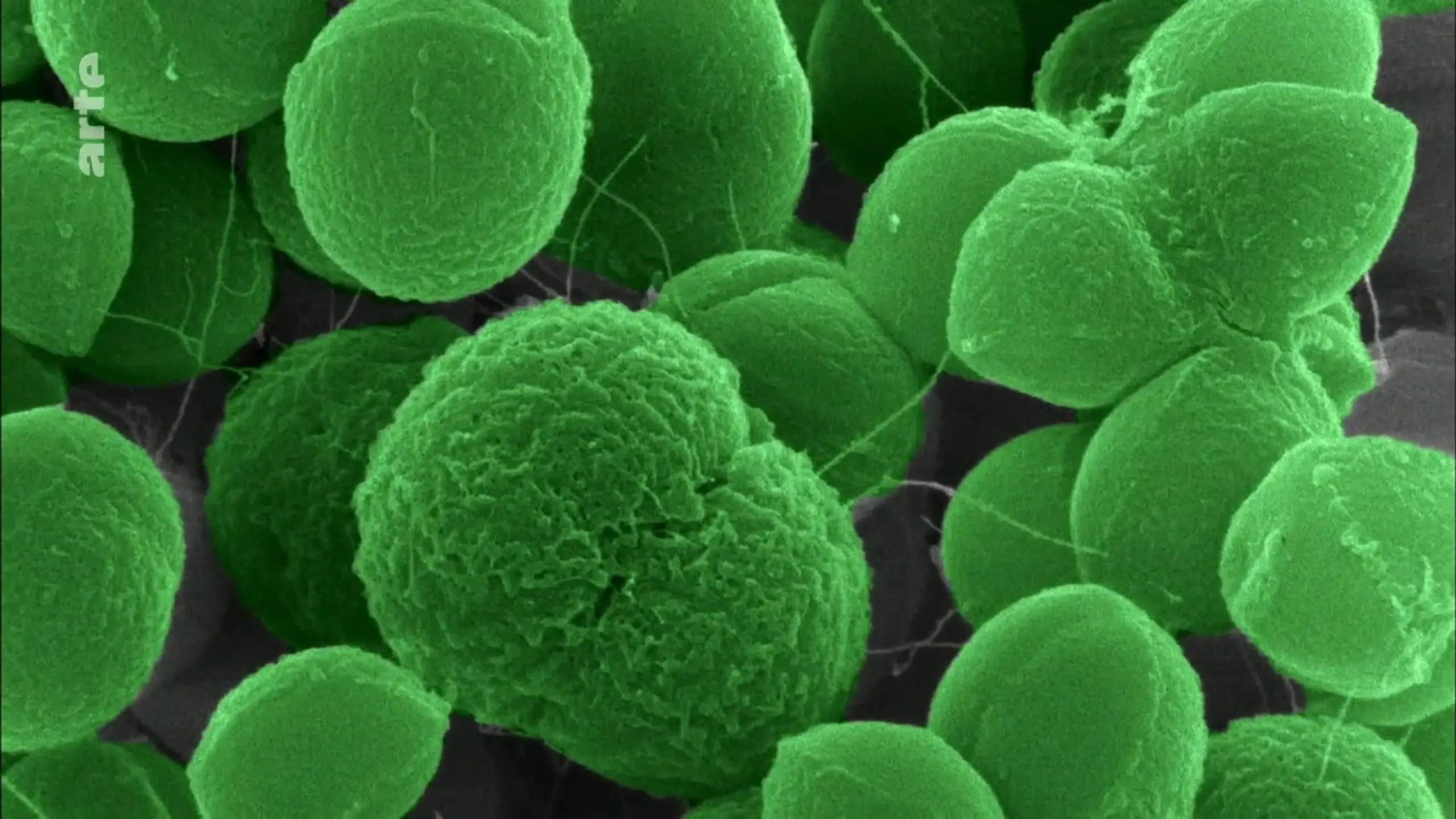 Resistente Keime – Die Entdeckung neuer Antibiotika