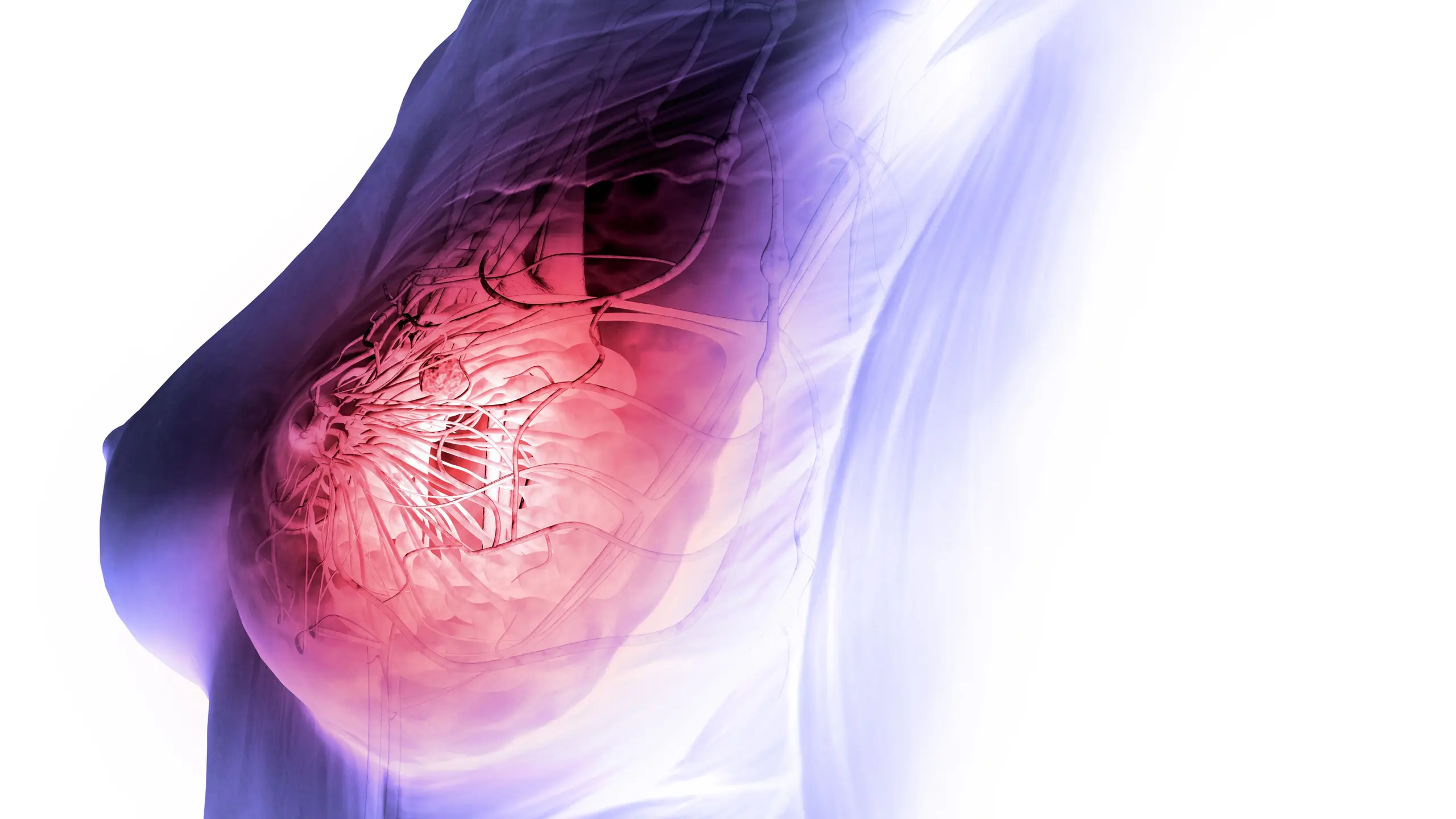 Brustkrebs, die häufigste Krebserkrankung der Frau, entsteht in der Brustdrüse.
