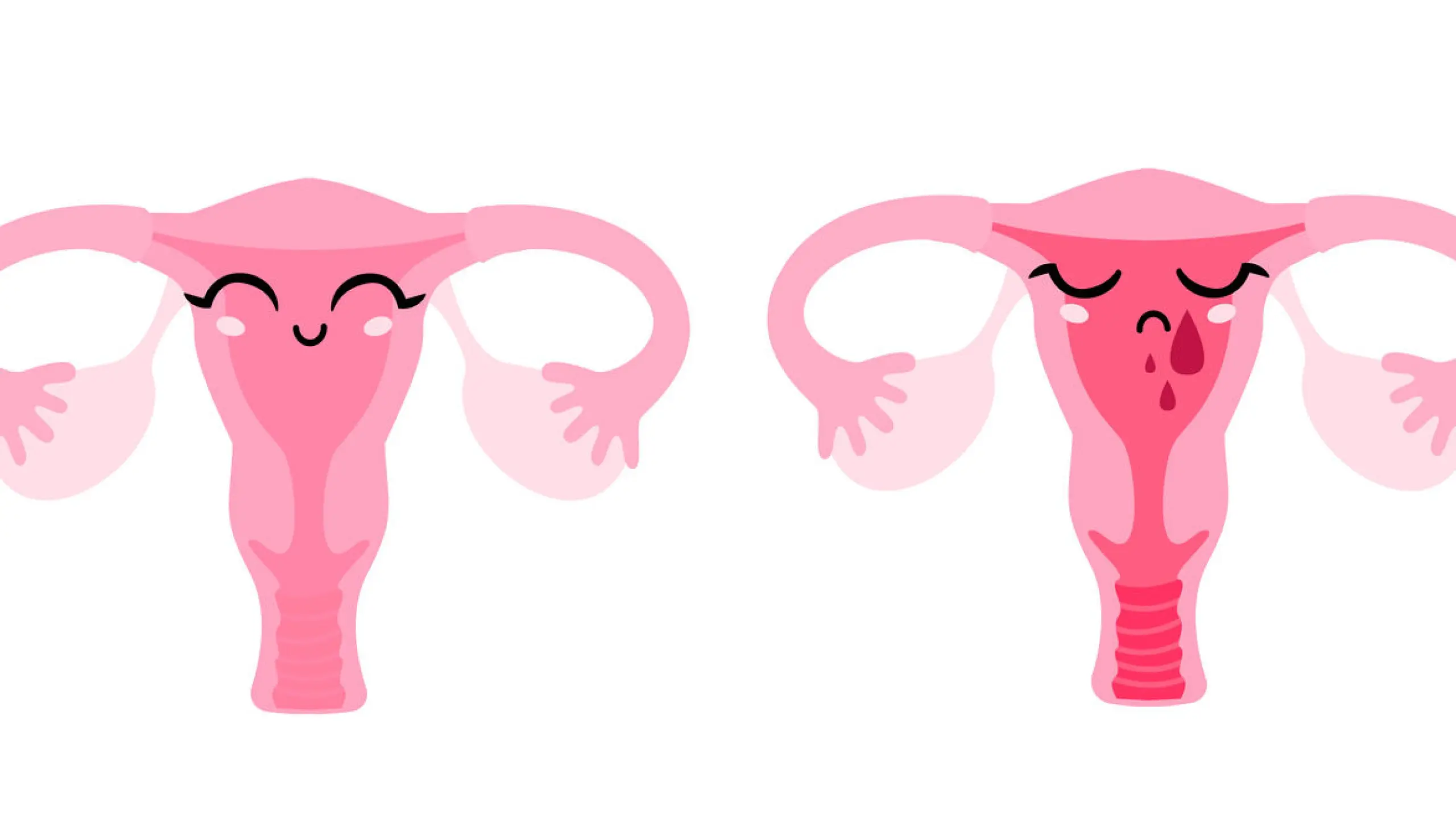 Menstruation: 6 Gründe, warum deine Periode zu früh kommt
